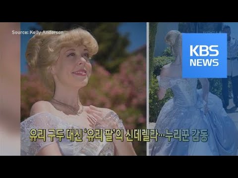 [클릭@지구촌] 유리 구두 대신 ‘유리 팔’의 신데렐라…누리꾼 감동 / KBS뉴스(News)