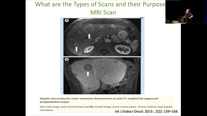 2018 National NET Patient Conference Day 1  - Henderson, NV - 05 Borges Neto