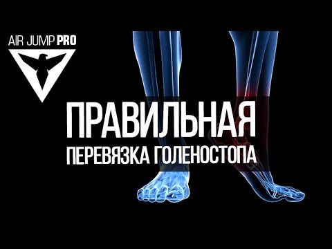 Растяжение голеностопа ноги | Наложение правильной повязки