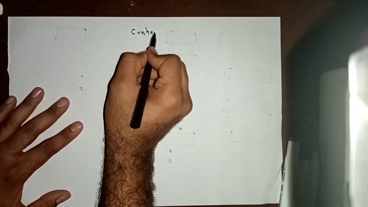 Femoral Triangle part II of II By Ahmed Belhaj