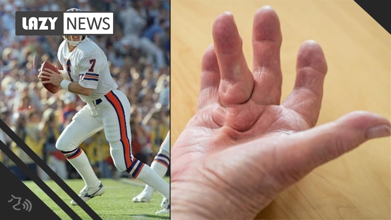 John Elway’s rare hand disorder nearly derailed post-playing bliss: 'Couldn’t straighten my fingers'