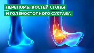 Переломы костей стопы и голеностопного сустава. Особенности лечения и последствия.