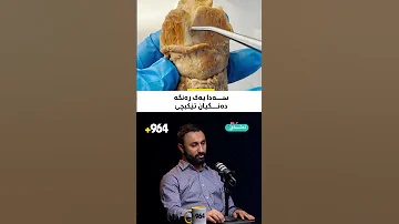 نەشتەرگەری غودە باشتر وایە لای ئەو دکتۆرە بکرێت کە زۆر شارەزا بێت د سەمیر بەرزنجی وادەڵێت 