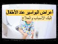 أعراض البواسير عند الأطفال وأسبابها وعلاجها 