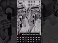 الفنان يحيى فرج بكيته يوم خلق الله سليه