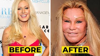 20 Celebrity Plastic Surgery Disasters