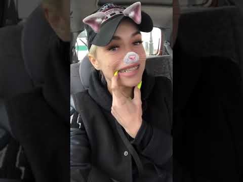 Настя Балинская в прямом эфире 01 03 2019  Была у хирурга, который испортил мне нос