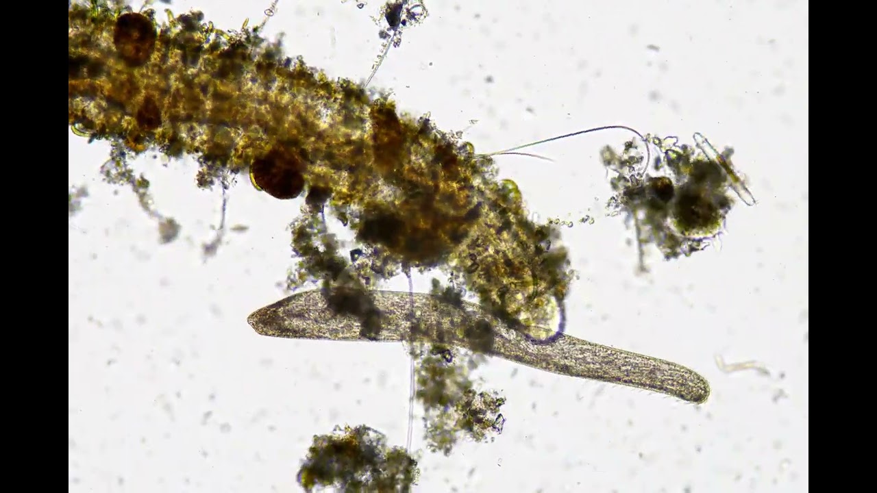 Fuzzy worm under a microscope