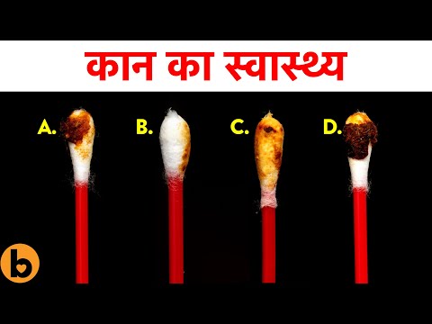 वीडियो: कटे हुए कानों की देखभाल कैसे करें (तस्वीरों के साथ)