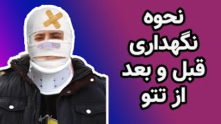 نحوه مراقبت ونگهداری قبل و بعد از تتو زدن