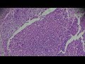 Single-Molecule Method Reveals Functional Inheritance of EGFRs in Extracellular Vesicles