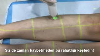 Dnz Polikliniği Bacak Lazer Epilasyon