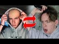 I Went Bald To See How Social Media Would React...