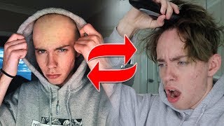 I Went Bald To See How Social Media Would React...