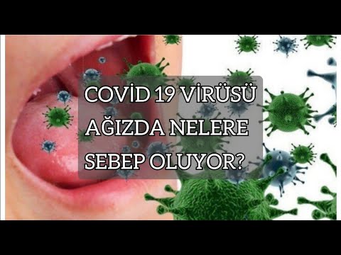 Covid 19&rsquo;un ağızdaki belirtileri. Corona ağzımızda nelere sebep oluyor? The oral signs of covid 19.