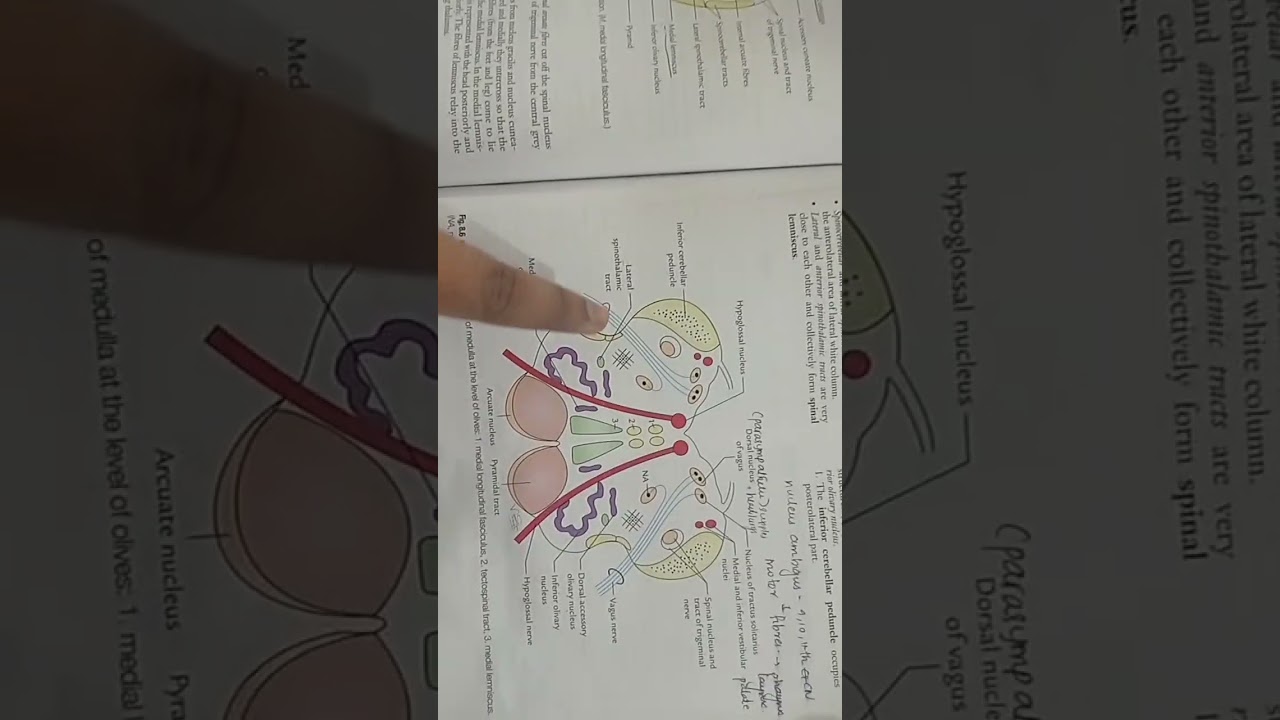 TS of medulla at level of olive