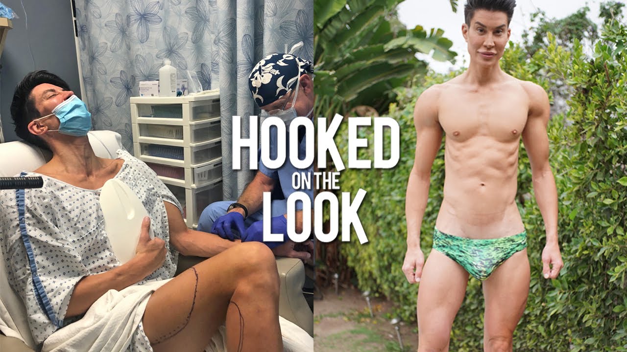 'Human Ken Doll' Gets World's First Multiple Leg Implants | HOOKED ON THE LOOK