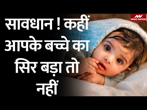 वीडियो: मनुष्य का सिर कितना भारी है?