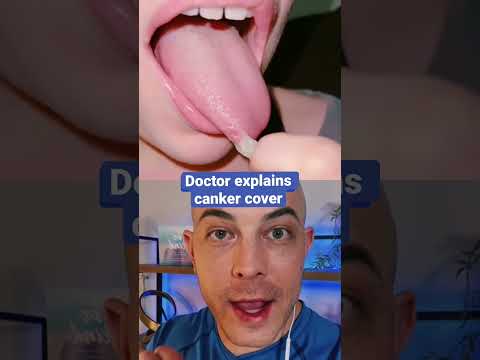 The best way to fix a canker sore!