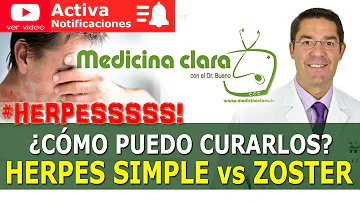 ¿Cómo puedo ayudar a mi cuerpo a recuperarse del herpes zóster?