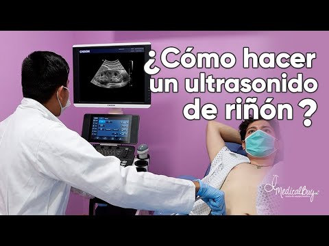 Vídeo: Ecografía De Los Riñones: Indicaciones, Preparación Para El Procedimiento, Cómo Se Realiza El Estudio