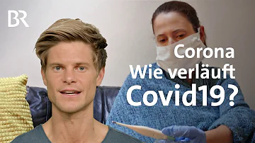 Wie fängt der Coronavirus an?