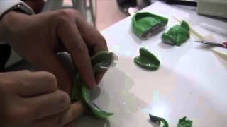 Pala Digital Dentures Separation