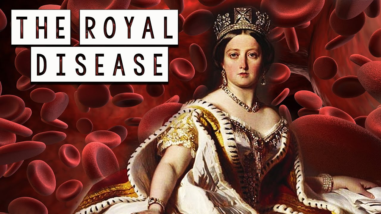 The Royal Disease - How Queen Victoria Spread This Disease Across European Courts (Hemophilia)