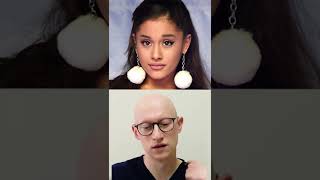 Ariana Grande New Face | Plastic Surgery Analysis