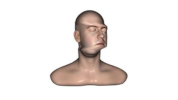 Slit LeePerrySmith Scan