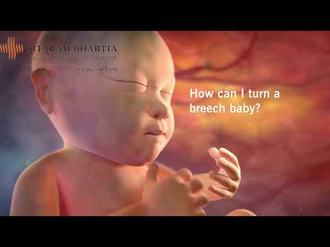 Breech Baby Turning Exercises | How to Turn Baby&rsquo;s Head Down Naturally