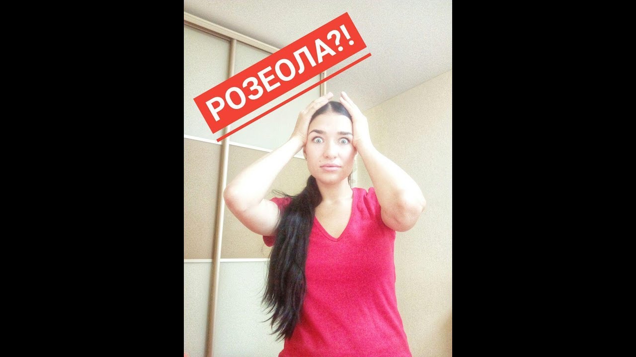 РОЗЕОЛА ИЛИ ЭКЗАНТЕМА. ВЫСОКАЯ ТЕПМЕРАТУРА У РЕБЕНКА 8 МЕСЯЦЕВ. СЫПЬ ...