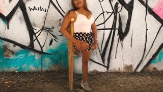 The Beautiful Woman Has An Amputated Leg And Walks On One Leg With One Crutch #Amputee