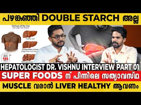 70% DAMAGE ആയാതിന് ശേഷമേ INTERVIEW ലക്ഷണങ്ങൾ കാണിക്കൂ | HEPATOLOGIST DR. VISHNU INTERVIEW PART 1