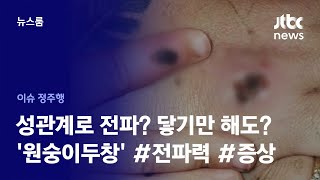 [이슈정주행] '원숭이두창'이 성병? 어떻게 전파되나…증상? 치료 방법은? / JTBC News