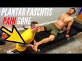 PLANTAR FASCIITIS GONE - YEARS OF PAIN