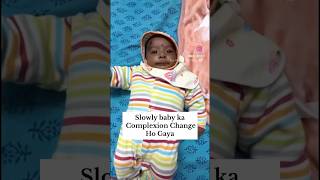 Baby ka skin color kaise change hua #shorts #shortvideo #baby #babyboy #babyskin #babyshorts #viral