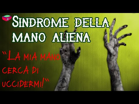 Video: Sindrome Della Mano Aliena: Cause, Sintomi, Trattamento