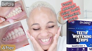 Smile With No Shame | First Time Using Teeth Whitening Strips.