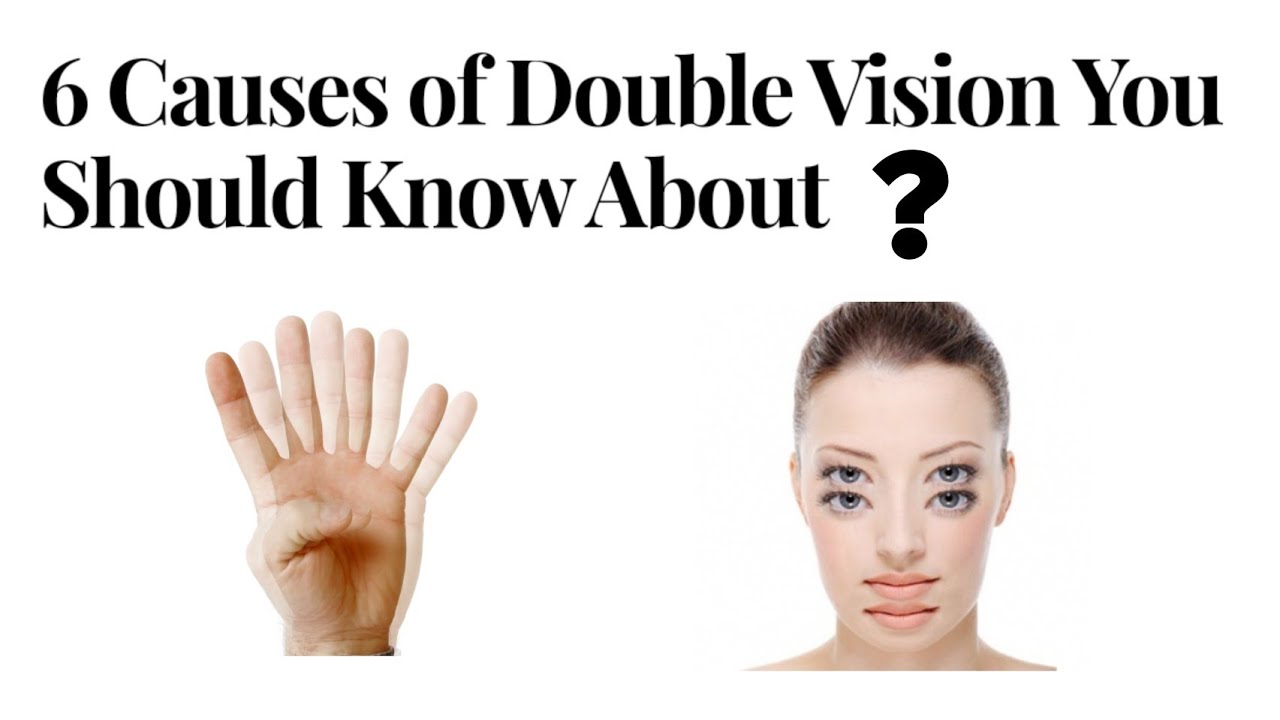 Double Vision Diplopia Causes In Eyes YouTube Double Vision Diplopia Causes In Eyes YouTube