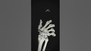 Dart-throwing motion