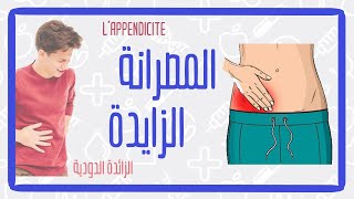 تدويزة :إلتهاب المصرانة الزايدة    -     TEDWIZA : appendicite