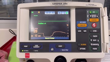 End Tidal CO2 on Defibrillator