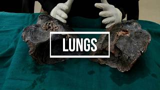 Lungs - gross anatomy screenshot 3