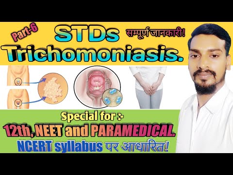 Trichomoniasis | (Causes, Symptoms, Treatment and More - कारक, लक्षण, इलाज एवं अन्य).Class 12th Bio.