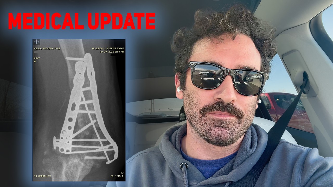 Плохие новости... борьба за спасение моей руки.