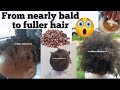 ONLY 3 MOST POWERFUL INGREDIENTS that STIMULATES FAST HAIR GROWTH like Never BEFORE