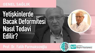 Yetişkinlerde Bacak Deformitesi Nasıl Tedavi Edilir?