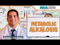 Metabolic Alkalosis