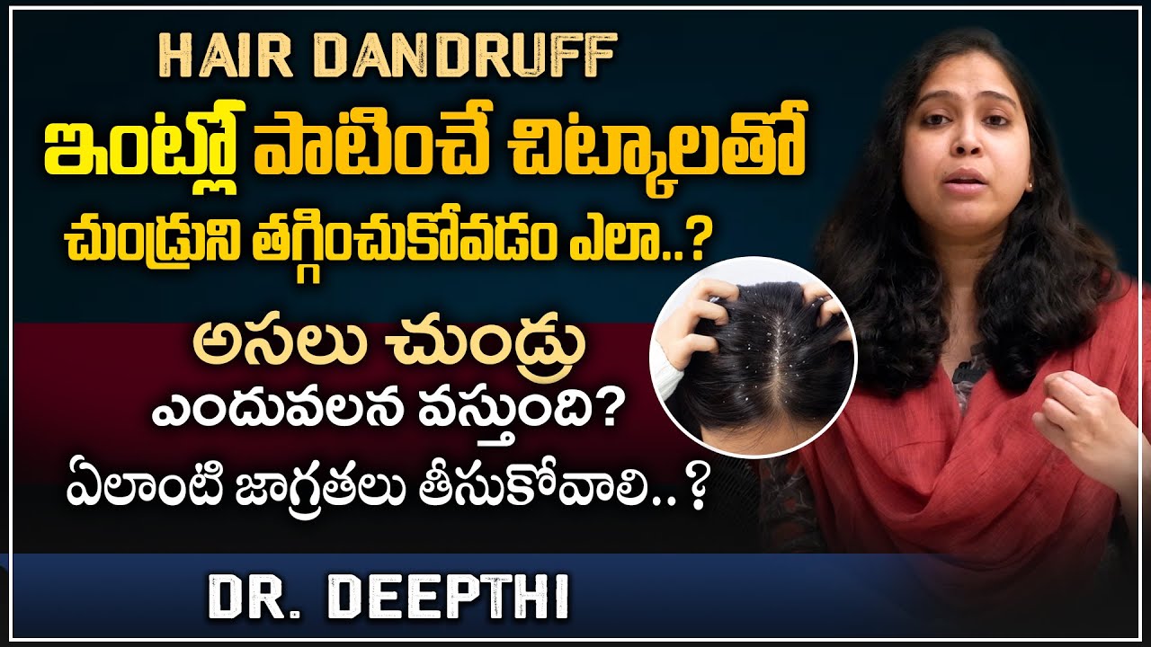 ఇంటి చిట్కాలతోనే చుండ్రును తగ్గించుకోవడం ఎలా ? - Home Remedies For Dandruff || Telugu Health Focus